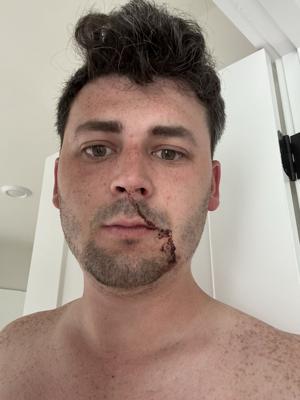 Seattle PD forwards felony assault charge to prosecutor 10 days after journalist attacked